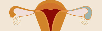 输卵管造影—输卵管